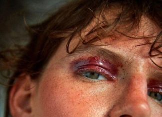 Fashion Editorial : “Fire Burning”
Hirschy Grace by Sam Hendel for Russh…